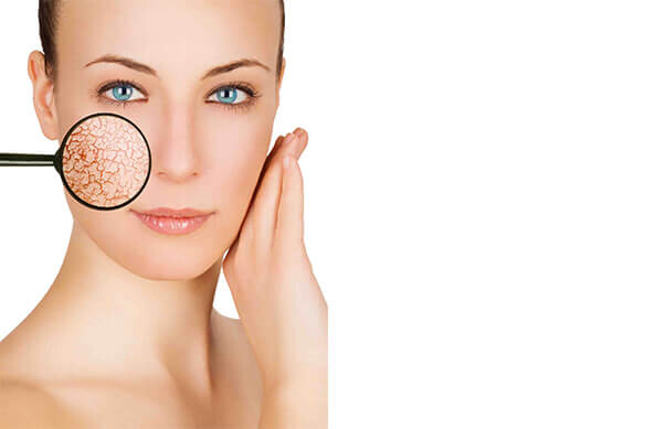 CİLT KIRIŞIKLIKLARI