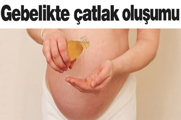 Çatlak oluşumları: