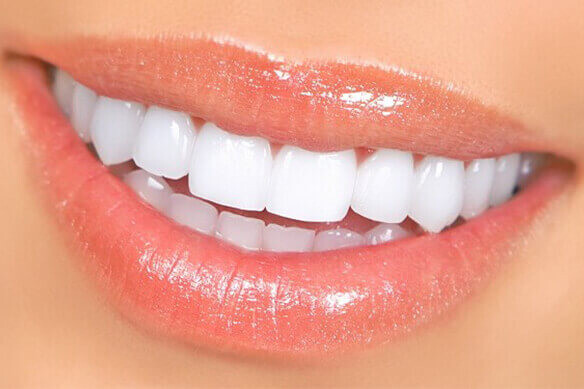 Dişlerde Asit Aşınması