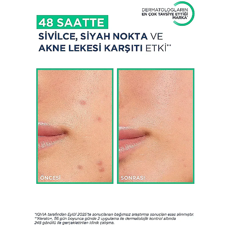 Bioderma Sebium Kerato+ Sivilce Lekesi Karşıtı Krem 30 ml - 4