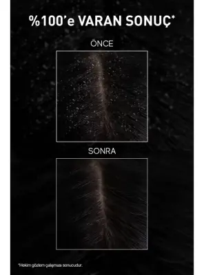 Bioxcin Aqua Thermal Kepek Karşıtı+Yoğun Kepek Karşıtı Şampuan Seti 200 ml + 300 ml - 5