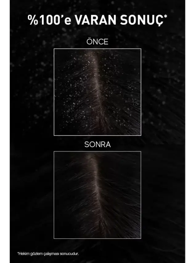 Bioxcin Aqua Thermal Kepek Karşıtı+Yoğun Kepek Karşıtı Şampuan Seti 200 ml + 300 ml - 5