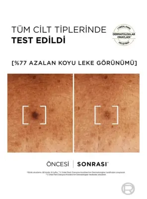 Loreal Paris Bright Reveal Niasinemid - Koyu Leke Karşıtı Serum - 30 ml - 7