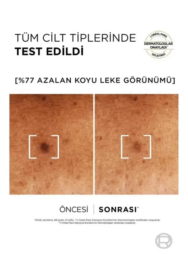 Loreal Paris Bright Reveal Niasinemid - Koyu Leke Karşıtı Serum - 30 ml - 7