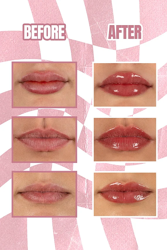 Maruderm Dolgunlaştırıcı Etkili Dudak Parlatıcısı – Plumping Lip Gloss Ruby Fire - 2