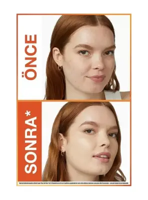 Maybelline New York Super Stay Skin Tint Fondöten - 10 30ml - 4