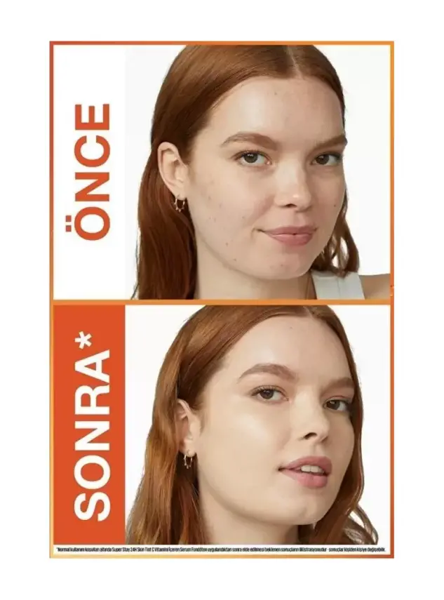 Maybelline New York Super Stay Skin Tint Fondöten - 10 30ml - 4