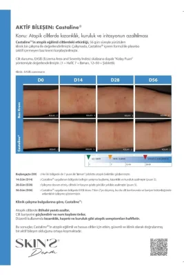 Skins Derm Ceramide NP+ Intensive Therapy & Moisturizer Cream 60ml - 6