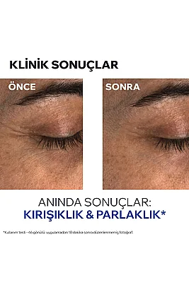 Uriage Age Absolu Global Yaşlanma Karşıtı Göz Balmı 15 ml - 4