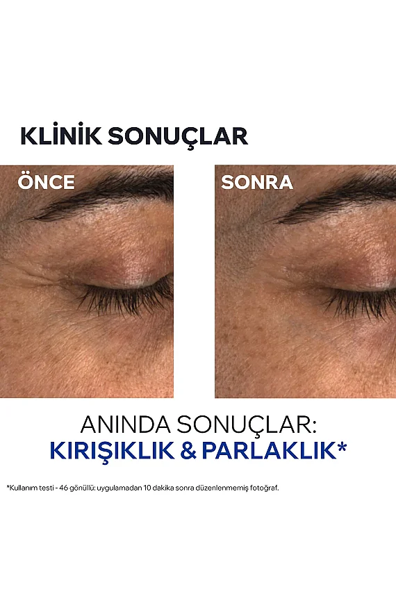 Uriage Age Absolu Global Yaşlanma Karşıtı Göz Balmı 15 ml - 4