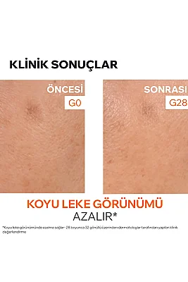Uriage Depiderm Leke Karşıtı C Vitamini Serum 30 ml - 4