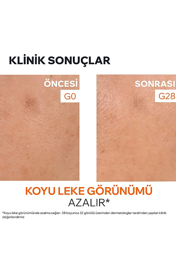 Uriage Depiderm Leke Karşıtı C Vitamini Serum 30 ml - 4