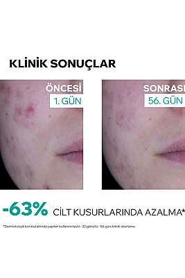 Uriage Hyseac -Regul + Akneye Eğilimli Ciltler İçin Leke ve Siyah Nokta Oluşumunu Önleyen Krem 40 ml - 3