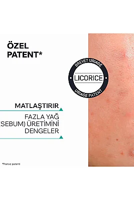 Uriage Hyseac -Regul + Akneye Eğilimli Ciltler İçin Leke ve Siyah Nokta Oluşumunu Önleyen Krem 40 ml - 6