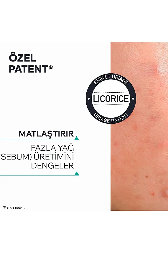 Uriage Hyseac -Regul + Akneye Eğilimli Ciltler İçin Leke ve Siyah Nokta Oluşumunu Önleyen Krem 40 ml - 6