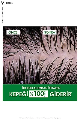Vichy Dercos Anti-Pell Kepek Şampuanı Normal ve Yağlı Saçlar 200 ml - 3