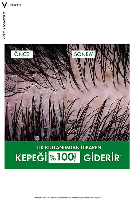Vichy Dercos Anti-Pell Kepek Şampuanı Normal ve Yağlı Saçlar 200 ml - 3
