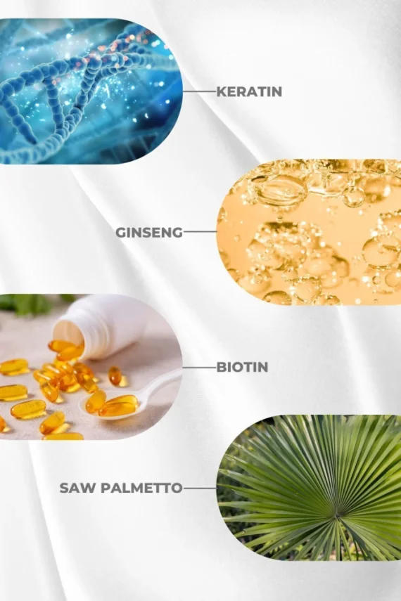 Zigavus Forte Saç Dökülmesine Karşı Şampuan - Kuru Ve Normal Saçlar - 300 ml 3 Al 2 Öde - 3