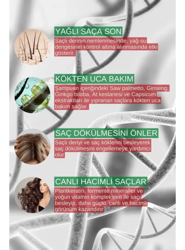Zigavus Forte Saç Dökülmesine Karşı Şampuan - Yağlı Saçlar - 300 ml 3 Al 2 Öde - 1